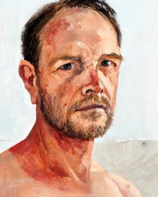 Self Portrait with sun damage, 2014 by Andrew Sayers.